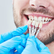 Dentysta dopasowujący licówki do koloru zębów pacjenta